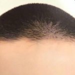 [EXO] 경수 이마포카
