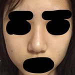 [드루와] <b>사진</b>빛삭)<b>코</b>가 넘커 ㅜㅜ