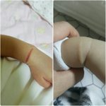 [방탈죄송] 추가///신생아집중치료실에서의  아기 상처