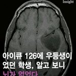 [드루와] <b>아이큐</b> 126 우등생이였는데 뇌가 없었대