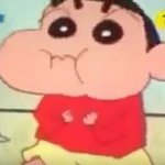 [<b>기절</b>했었음] 나 어제 쌍수했는데 질문다받아 !!