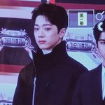 [드루와] 쌍수 오눌 했는데 너무아파....ㅜㅜ