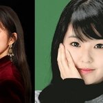 아이린 <b>쌍꺼풀</b>