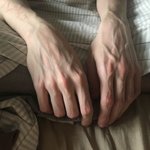 [댓글부탁해] 남자 <b>목젖</b> vs 핏줄