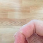 콜라 따다가  손에 <b>물집</b>잡혔는데 우째 해야돼?