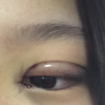 <b>쌍수라인</b> 봐주라 ㅠㅠ