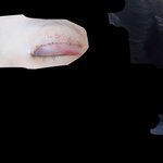 쌍수할<b>때</b> <b>눈</b>에힘주지마 나처럼돼ㅠㅠ @혐짤주의@