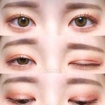 <b>이눈</b> 들고 쌍수상담 받을까?