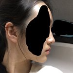 옆모습 어때...? 코 굴곡진게 너무 스트레스야