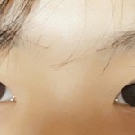 나 쌍수할까(사진ㅇ