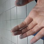 [댓글부탁해] 손가락이 파랗게 <b>변해</b> ㅠㅠ(사진있음)