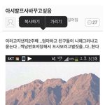 여름에 쌍수 한 사람 있음...?