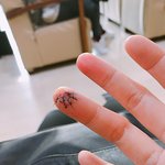 [퍼날라주셈] 홍대 방탈출카페에서 다친 후기 [사진 약간 혐..]