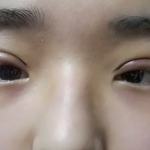 [댓글부탁해] 쌍수망한거야,,?