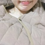[댓글부탁해] 나 쌍<b>덧니</b> 스트레스 진짜 심했는데