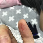 키우던 강아지 <b>한테</b>물렸는데 어떡해