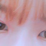 나 앞트임할까 <b>답안</b>하면 멍청이 사진있음