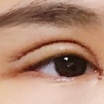[댓글부탁해] <b>쌍수</b>했는데 붓기 어때?