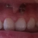 [드루와] 약혐))입 안에 <b>셀프</b>피어싱했당!!