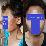 [꼭봐주세요] <b>헤나</b>염색제 피해자 또 계신가요