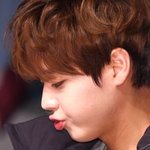 [댓글부탁해] 아나 교정 <b>와이어</b> 빠짐(;;;;;;