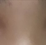 [댓글부탁해] <b>쌍수</b> 붓기 ..ㅜ