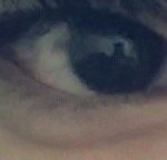 [댓글부탁해] 쌍수상담 <b>연옌</b> 사진들고 달려는데 추천좀