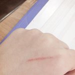 이거 상처<b>난거</b> 이상해??
