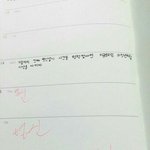 [댓글부탁해] 교정 스크류 <b>박아</b>본애들잇어?