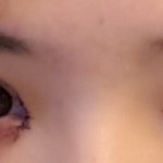 <b>쌍수라인</b>봐쥬면좋은일생김