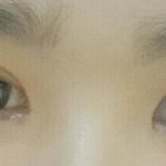 [댓글부탁해] <b>쌍수</b> <b>라인</b>