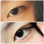 나 <b>쌍</b><b>액</b>하다 <b>쌍</b>커풀생김