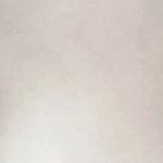 [댓글부탁해] 쌍수 10일차눈좀봐주세요