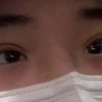 쌍수잘된거야?