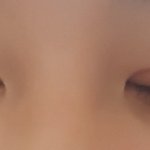 [조언부탁해] 나 쌍수한지 이<b>주정</b>도 되는데 원래이래?