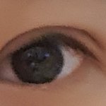 [조언부탁해] 쌍수하면 원래 <b>점막</b>드러나?