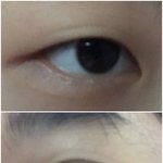 [드루와] 쌍수한지 6개월 됐는데 어떰?