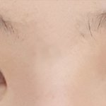 쌍수 6개월! 좀 봐주세용