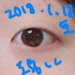[드루와] <b>내</b> <b>눈</b> 좀 봐줘!!