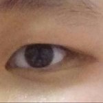 나 이 성형 할건데 수능끝나고 해도 될까