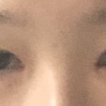 [댓글부탁해] 쌍수 11일차 좀 봐줘..
