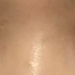 [조언부탁해] 얘들아 급해 제발 <b>쌍수라인</b> 좀 결정해줘 ㅜ
