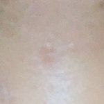 [조언부탁해] 쌍수 <b>이주</b>차인데 짝짝이 같아 들어와바..