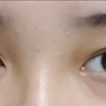 [드루와] 다크써클 마이심함?