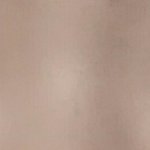 [조언부탁해] 나 재수술할지말지 봐<b>쥬</b>라