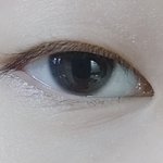 [댓글부탁해] <b>꼬막눈</b> 진단