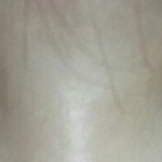 애드라 쌍수할려구 눈 좀 봐줘 ㅠㅠ