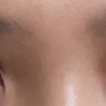 [댓글부탁해] 쌍수 라인 좀 봐줘ㅠㅠ