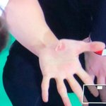 [세븐틴] <b>정한</b>이 다친 손
