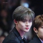 (<b>미방</b>) 3일짼데 이정도면 붓기 갠찬은거지 ??